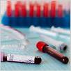 test del sangue shbg: test di laboratorio da medlineplus